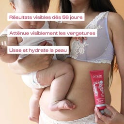 Omum Crème Réparatrice Vergetures 