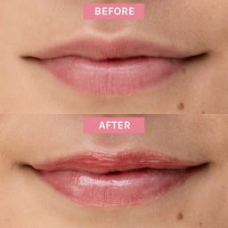 Evolve Organic Beauty Bio-Retinol Glossy Lip Oil - 15 ml