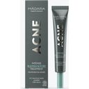 MÁDARA Organic Skincare Acne Intense Blemish & Pore Treatment - 20 мл